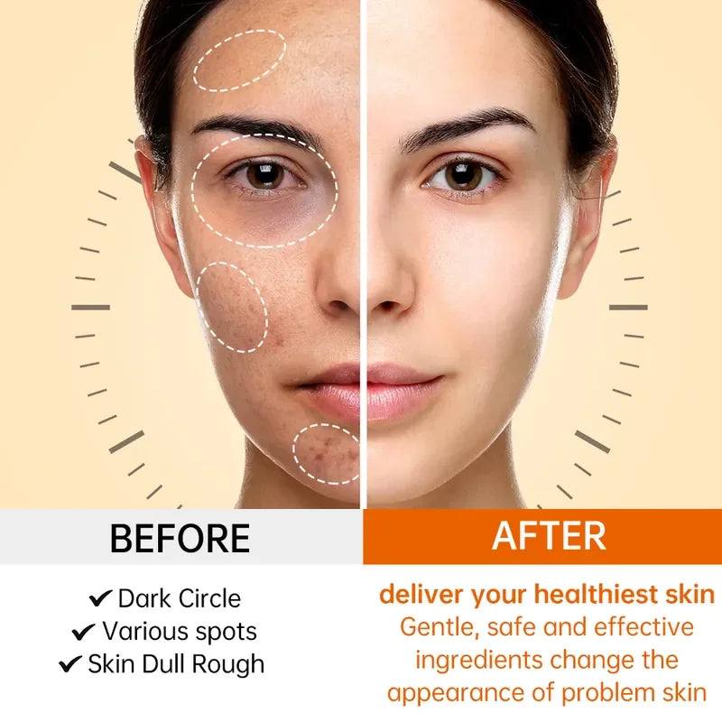 JoyPretty Vitamin C for Face Cream Whitening Dark Spots Removal Shrink Pore Serum Moisturizing Lighten Facial Skin Care Products