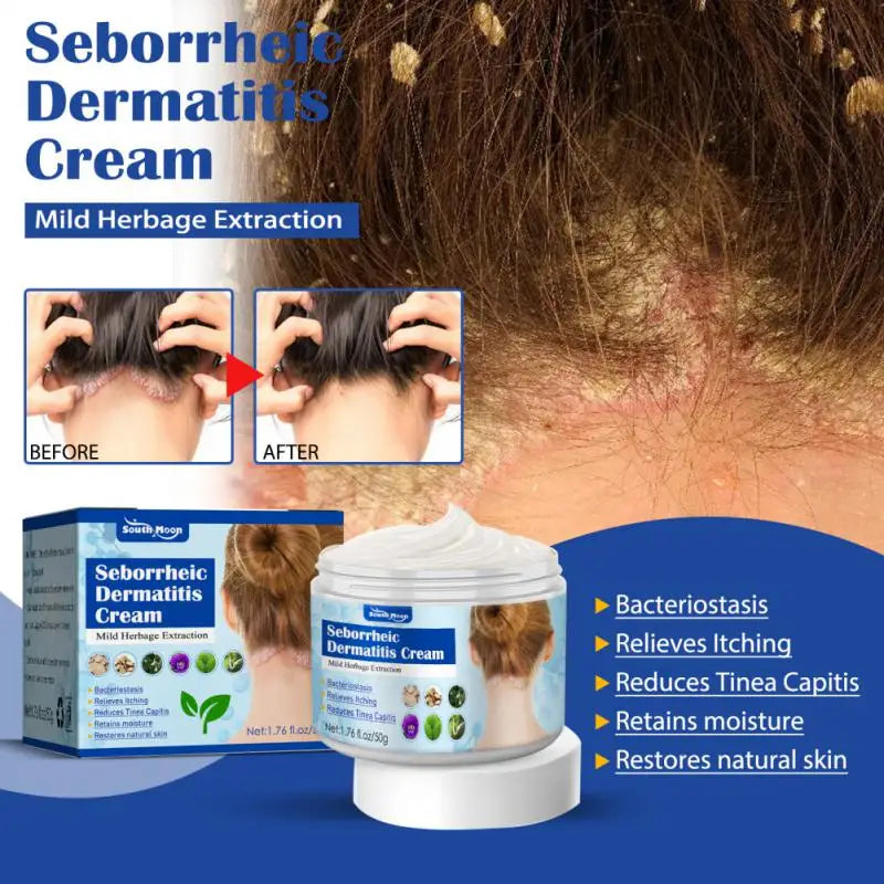 50g Seborrheic Skin Cream Head Acne Pruritus Scalp Ringworm Skin Problem Repair Skin Cream Skin Cleansing Cream Hair Scalp Care