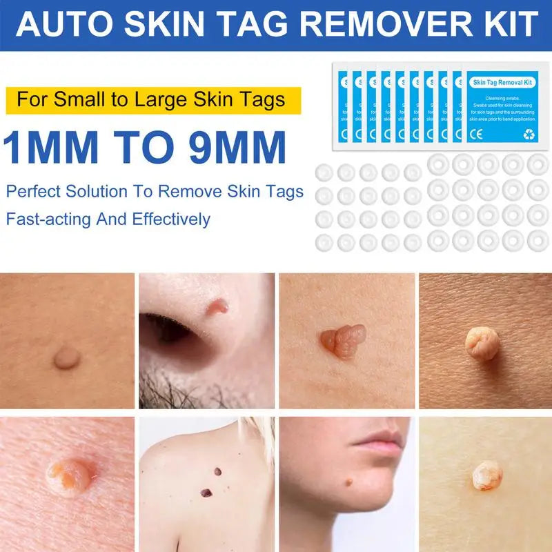 Skin Mole Wart Remover Skin Care Tool For Safe Mole Stain Wart Removal Face Care Beauty Tools Skin Tag Wart Removal Kit Cleaning