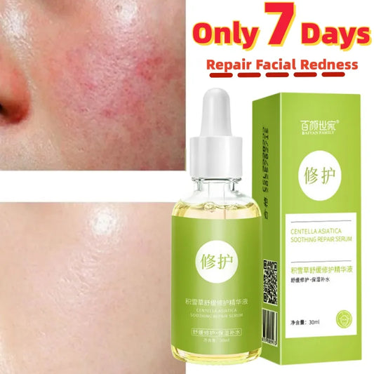 Instant Repair Facial Redness Serum Red Blood Itching Treatment Cream Shrink Pore Rosacea Skin Moisturize Sooth Face Whiten Care