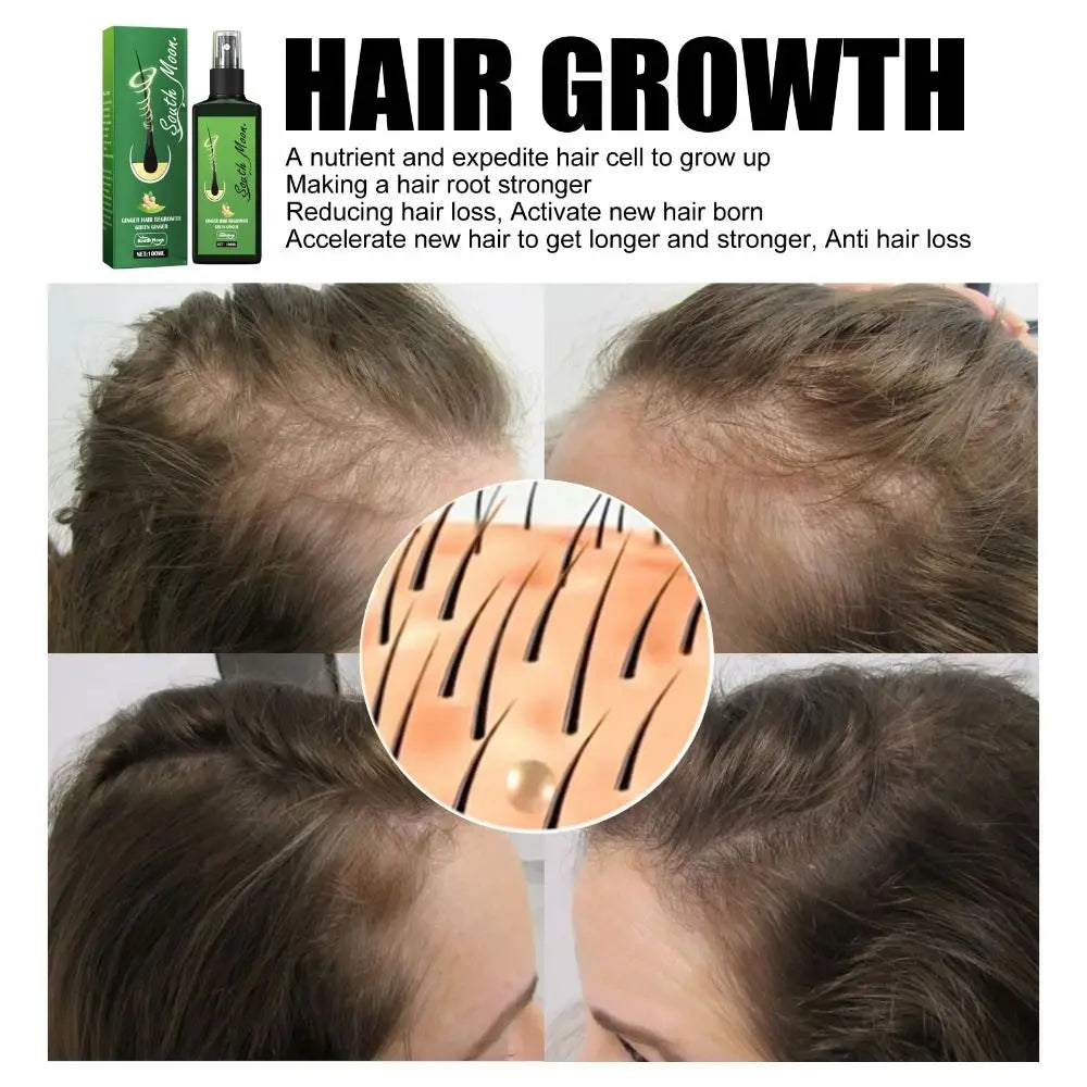 120ML Hair Growth Lotion Haircare Hair Loss Oil Baldness Repair Spray Skin Care Beauty Health Wash-Free Anti Natural Extract
