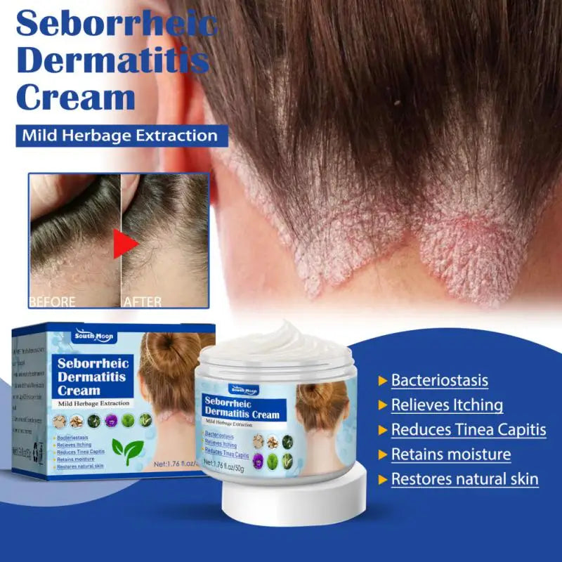 50g Seborrheic Skin Cream Head Acne Pruritus Scalp Ringworm Skin Problem Repair Skin Cream Skin Cleansing Cream Hair Scalp Care