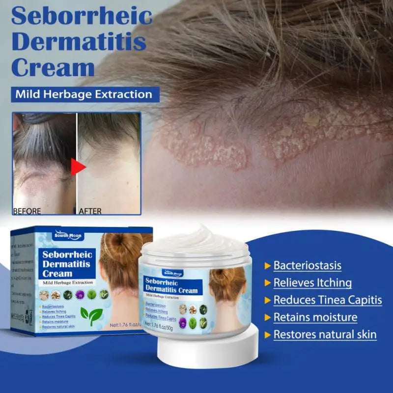 50g Seborrheic Skin Cream Head Acne Pruritus Scalp Ringworm Skin Problem Repair Skin Cream Skin Cleansing Cream Hair Scalp Care