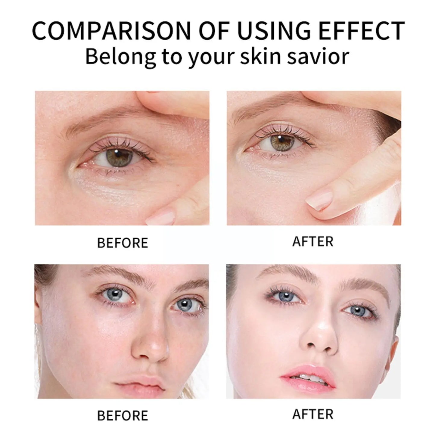 5pcs Face Care Sets Turmeric Facial Acne Cleansing Cream Anti-Aging Serum Dark Skin Moisturizing Spots Turmeric Fade O8B2