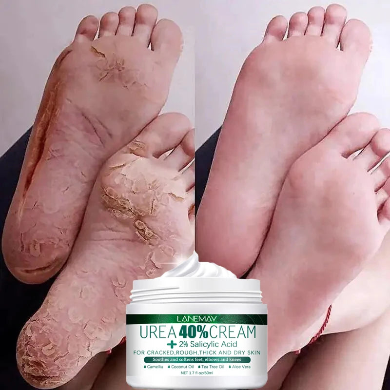 Herbal Anti Crack Foot Cream Heel Cracking Repair Products Exfoliation Dead Skin Removal Softening Moisturizing Hand Feet Care