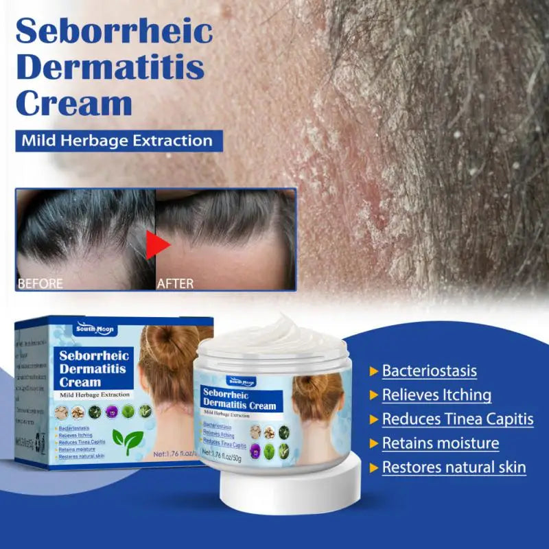 50g Seborrheic Skin Cream Head Acne Pruritus Scalp Ringworm Skin Problem Repair Skin Cream Skin Cleansing Cream Hair Scalp Care